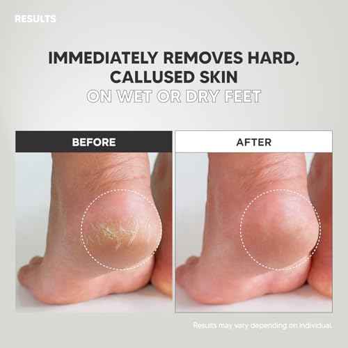 Wide Emery, Double-Sided Pedicure Tool, Colossal Foot File for Men & Women, Effective for Cracked Heel, Callus Remover, Foot Scrubber, Professional, (Gray)