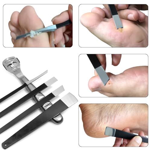 Callus Shaver & Pedicure Tool Kit - 36 Piece Stainless Steel Foot File Set