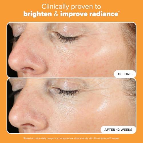Paula's Choice BOOST C15 Super Booster, 15% Vitamin C Serum for Face, Face Serum with Vitamin E & Ferulic Acid for Discoloration & Glow, Fragrance-Free