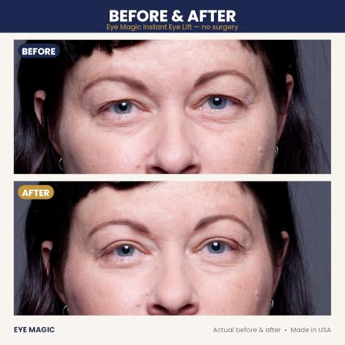 Eye Magic Premium Eye Lift Strips 80 Count Refill Pack - Medium Size, Hypoallergenic, No Gel, Strong Hold, Made in USA