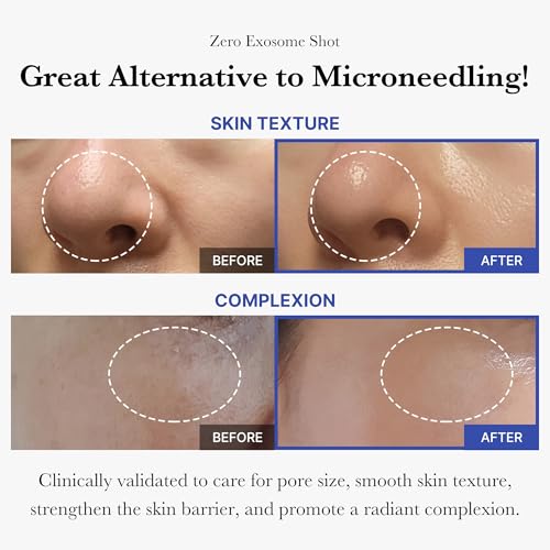 Medicube Zero Pore Set with Exosome Serum & Pore Refining Pads