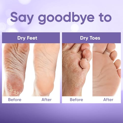 CÉLOR Foot Peeling Mask - Exfoliate Dry Cracked Feet (2 Pairs)