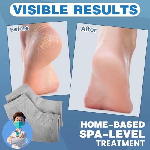 TEAWOO Gel Heel Socks - 6 Pairs Moisturizing Treatment for Cracked Feet