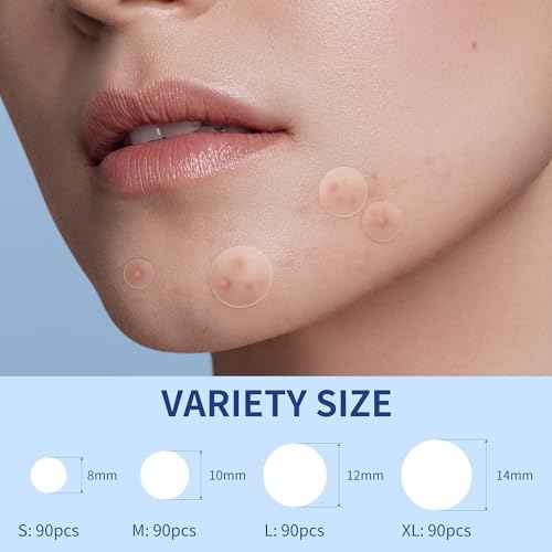 Pimple Patches for Face, 4 Size 360 Counts Hydrocolloid Acne Patches for Covering Zits and Blemishes, Spot Stickers with Salicylic Acid, Tea Tree Oil & Calendula Oil, Mini Package
