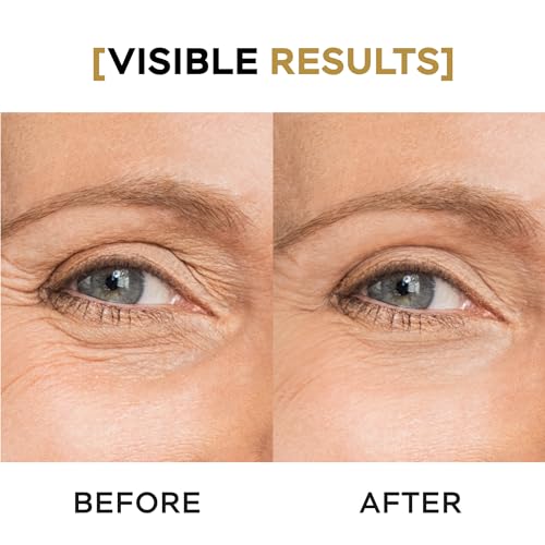 VITASEI Moisturizing Eye Cream w/Aloe Vera, Collagen, Hyaluronic Acid, Cotton Stem Cells for Dark Circles, Puffiness & Bags - Under Eye Hydration Cream for Women & Men (1 Fl Oz)
