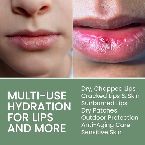 Organic Lip Balm Lip Treatment & Moisturizer for Dry Cracked Lips with Shea Butter & Vanilla, Ultra-Hydrating & Nourishing, Barrier-Repair Lip Therapy, Natural Skin Care, 6 Pack, Women & Men