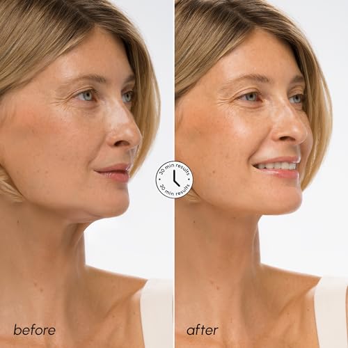 MAREE V Line Lifting Mask with Hyaluronic Acid ? Deep Collagen Face Mask for Women ? Jawline Shaper Facial Masks with Retinol ? Tightening & Firming Neck Lift Tape ? Double Chin Strap for Face Lift