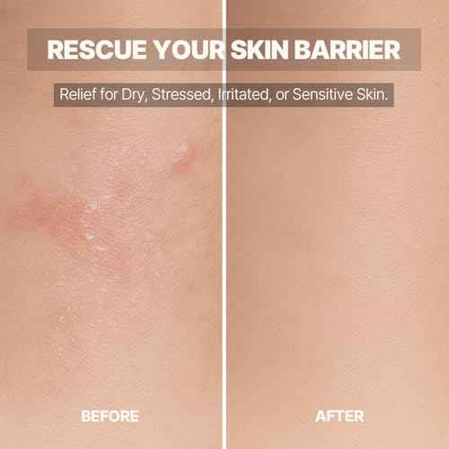 Calendula Cream | Face Moisturizer for Sensitive, Dry Skin | With Cica & Ceramide for Skin Barrier Repair & Hydration | 100% Plant Based