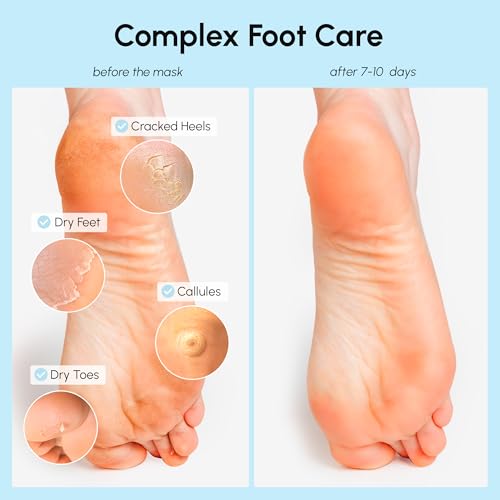 MAREE Exfoliating Foot Peeling Mask for Dry Cracked Feet & Calluses