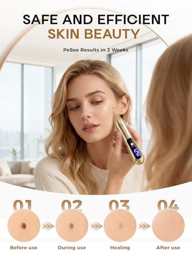 9-Speed Skin Tag Remover Pen with LCD Display