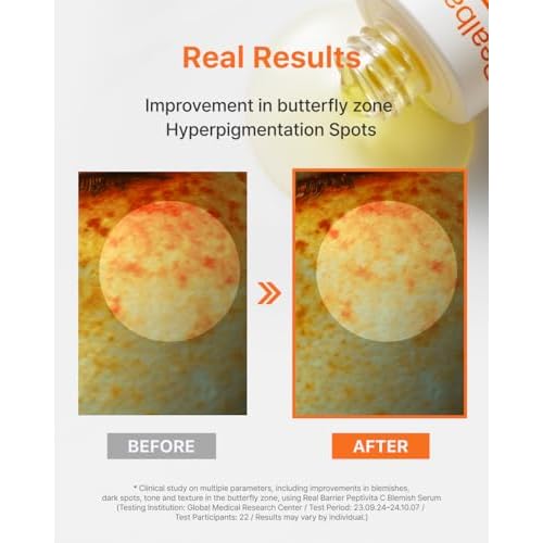 Real Barrier | Peptivita C Blemish Serum | Face Serum for Uneven Skin Tone & Smooth Texture | Vitamin C Face Care for Sensitive Skin | Facial Skin Care Products | Korean Skincare | 1.01 fl oz (30ml)