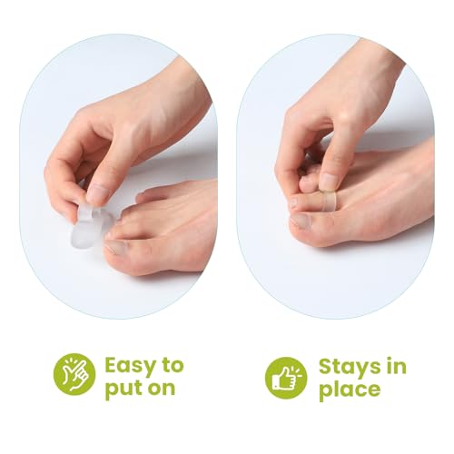 Hammertoe Corrector Gel Toe Straighteners - 12 Pcs Multi-Size