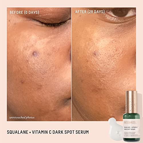 Biossance Squalane + Vitamin C Dark Spot Face Serum ? 10% Vitamin C Serum & White Shiitake ? Hydrating, Fragrance-Free, Non-Irritating, for Daily Use for All Skin Types