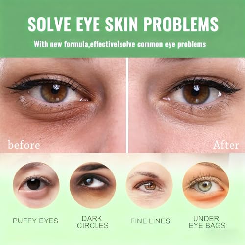 Firstfly 60 Avocado Eye Patches – Dark Circles & Puffiness Mask