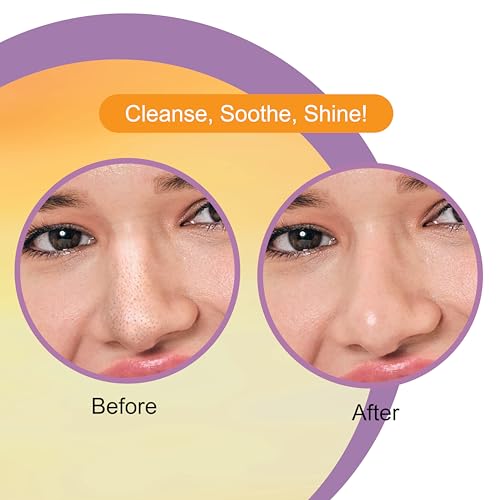 DR.RASHEL Vitamin C Nose Pore Strips For Pore Cleansing, Instant And Painless Blackheads Removal | Deep Purifying Blackhead Remover Strips for Nose | 20 PCS (10 Strips & 10 Wipes)