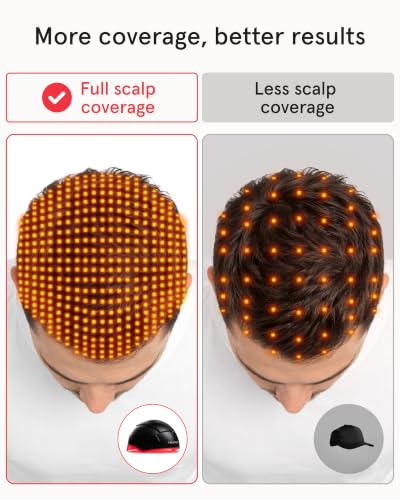 iRestore Elite Laser Hair Growth System for Men & Women - FDA Cleared Red Light Therapy for Hair Loss & Thinning