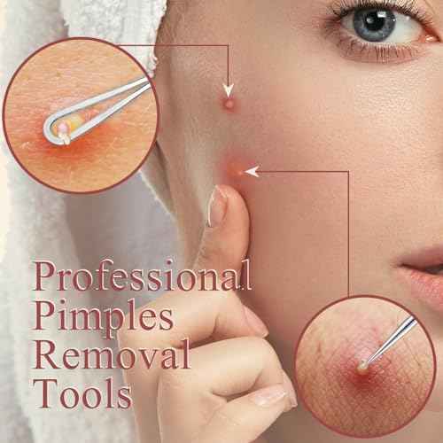 Ingrown Hair Tweezers and Pimple Popper Tool Kit, Pink Blackhead Remover Tools, Pimple Extractor Pore Extractor Eyebrow Razor, Scissor in Leather Travel Case