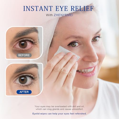 30PCS Tea Tree Oil Eyelid Cleansing Wipes,For Dry Eyes Daily Eye Care&Makeup Remover with Physiological Saline Removing Oil and Debris from Eyelids, Rinse Free Individually Wrapped Travel Essentials