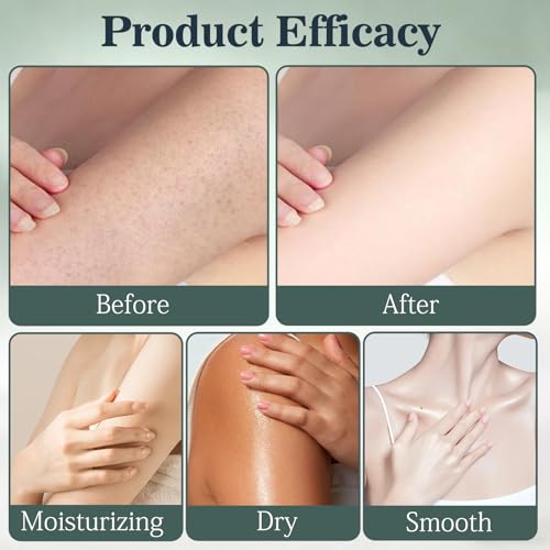 2026 New Intertrigo Cream, Professional Intertrigo Relief Cream, Skin Fold Care & Chafing Support Cream, Fast-Drying Non-Greasy Formula for Friction-Prone Areas (2Pcs)
