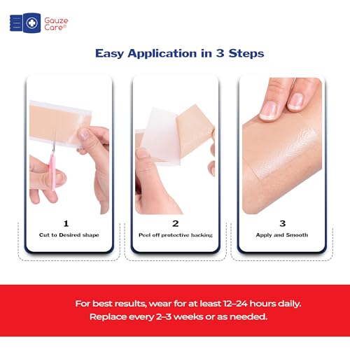 GauzeCare Silicone Scar Tape ? 1.6¡±x60¡± Roll ? Medical-Grade, Reusable, Professional Silicone Scar Tape for surgical scars, C-Section, Burns, Keloid, and Acne Scars