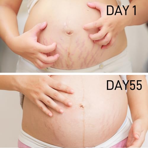 Pregnancy Stretch Mark Oil - Cocoa Butter & Vitamin E, 4.06oz