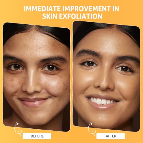 Valentine 's Day Gift for Women Pumpkin Enzyme Face Mask Skincare| Brightening Exfoliating Facial Mask For Dead Skin,Dullness Dark Spots, Uneven Skin Tone,Large Pores and Brightens Skin