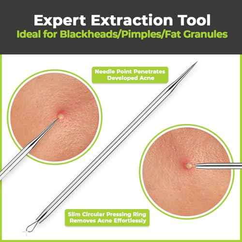 2 Pcs Pimple Extractor Tool Surgical Stainless Steel 410 | Comedone Extractor, Pimple Popper, Blackhead Remover for Face, Zit Popper, Pimple Needle for Acne Removal