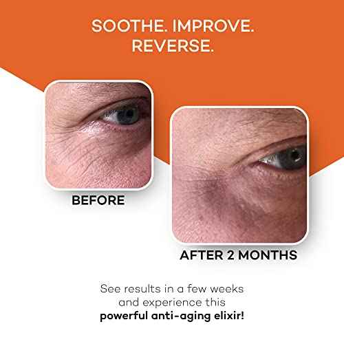 Zocufill Elixir Eye Gel and Face Serum - Eye Bags Treatment for Women and Men - Reduce the Appearance of Dark Circles, Puffy Eyes, Fine Lines and Wrinkles
