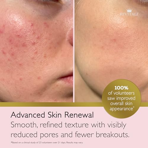 REVITALE Advanced Salicylic Acid Cream for Face & Body 80g ? Helps Smooth & Soften Skin Texture. For Rough, Bumpy & Blemish-Prone Skin