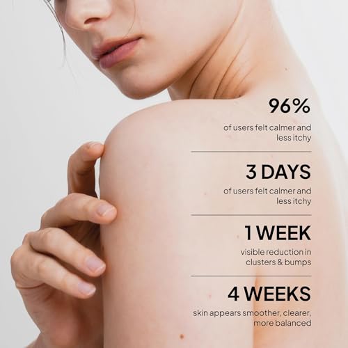 BellamiLuxx Fungal Acne Treatment Lotion for Face & Body - Natural Actives