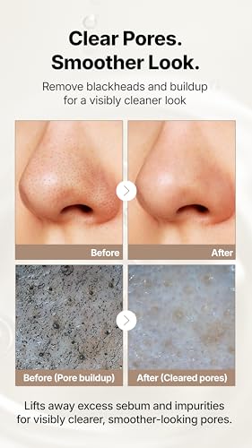 Starlike Black Pore Vita Cleansing Oil with Jojoba & AHA - 200ml