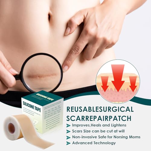 Silicone Scar Tape, Premium Silicone Gel Scar Sheets (1.6"x 60" Roll-1.5M), Reusable Silicone Patches, Soft Silicone Tape for Surgeries Scars, C-Sections, Wrinkles et