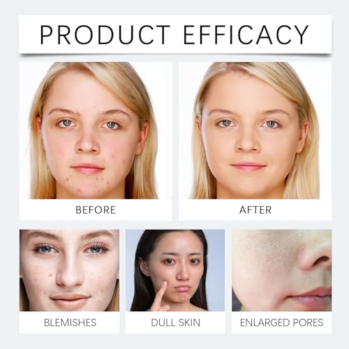 Gentle Foaming Facial Cleanser for All Skin Types