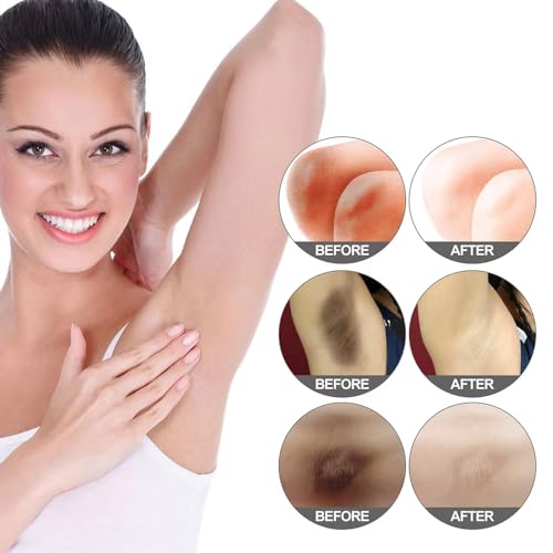 Crema para Aclarar las Axilas y Partes Intimas, Eliminador de Manchas Oscuras para la Cara, Crema Aclaradora para ?reas ?ntimas, Cuello, Axilas, Codos, Muslos Internos y Rodillas