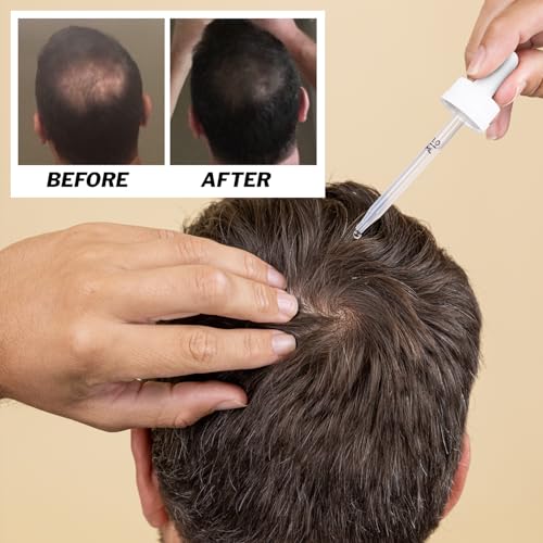 Shapiro MD Men's Regrowth Kit Plus with 5% Minoxidil