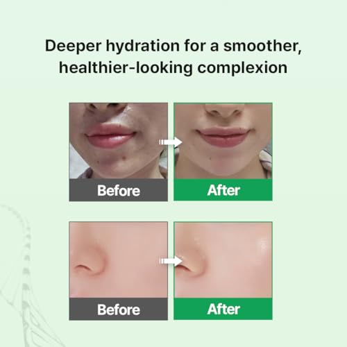 Zipiderm EGF Skin Barrier Hydro Ampoule ? Korean Lightweight Hydrating Serum with Ceramides, PDRN & Niacinamide | Barrier-Supporting Skincare for Sensitive & Delicate Skin | 1.01 fl oz