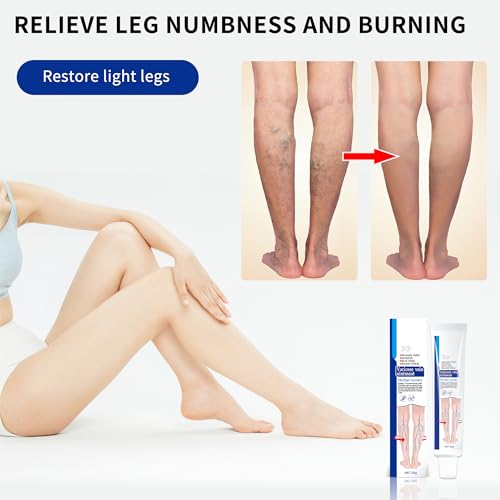 KONGDY Varicose Vein Relief Cream - 2 Count for Smooth Legs
