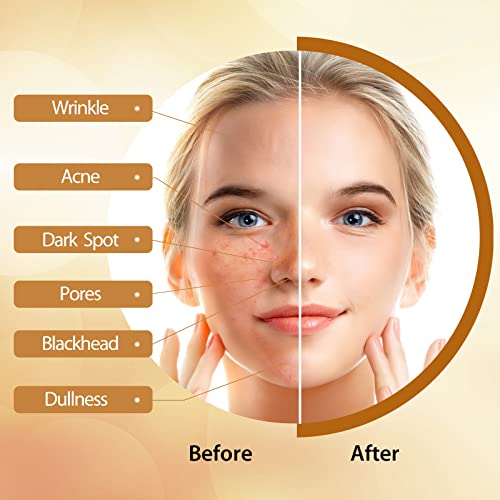 POP MODERN.C Kojic Acid Soap Turmeric Soap Dark Spot Remover for Face and Body Bath Soap Lightening Moisturizing Even out Tone Skin Vitamins C for Acne Blackheads Remover 3x100g