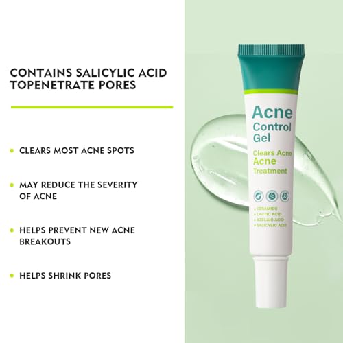 Azelaic Acid Serum for Face Acne Treatment, Body Acne Clearing Treatment with 10% Azelaic Acid & Salicylic Acid, Sensitive Skin Care Facial Essential Cream for Recurring Breakouts Refine Pores 30ml