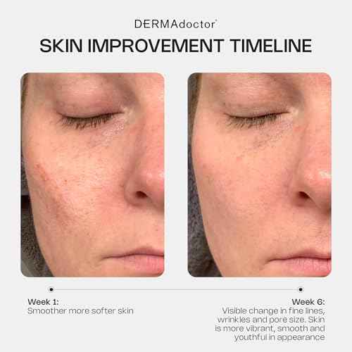 DERMAdoctor Retinol Cream for Face - Stabilized Vitamin C, Vitamin E, Ferulic Acid Anti Aging Face Cream 1% Retinol Facial Moisturizer Night-Cream for Dullness, Discoloration, Fine Lines, & Wrinkles