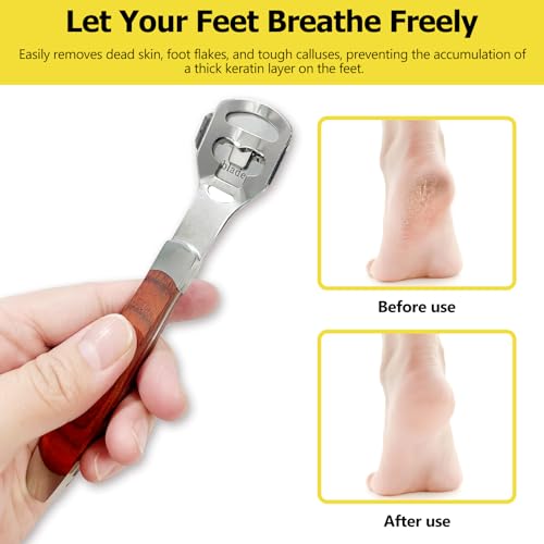 Foot Callus Remover Shaver with Wooden Handle & Extra Blades - Pedicure Tool