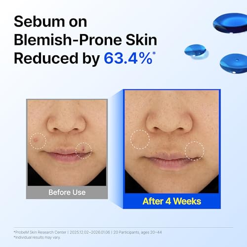 DearKlairs Korean EGF Serum ? Blue Youth Activating Drop with EGF Peptides and Guaiazulene, Repairing Serum for Redness and Blemish-prone Skin, Visibly Fades Post-Blemish Marks, 0.33 Fl Oz