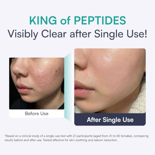 Botulinum Peptide Needle-Free Ampoule Serum 50ml