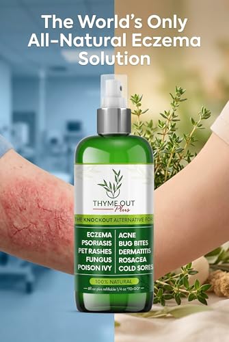 Thyme Out Natural Skin Relief Spray for Eczema, Acne & Irritation