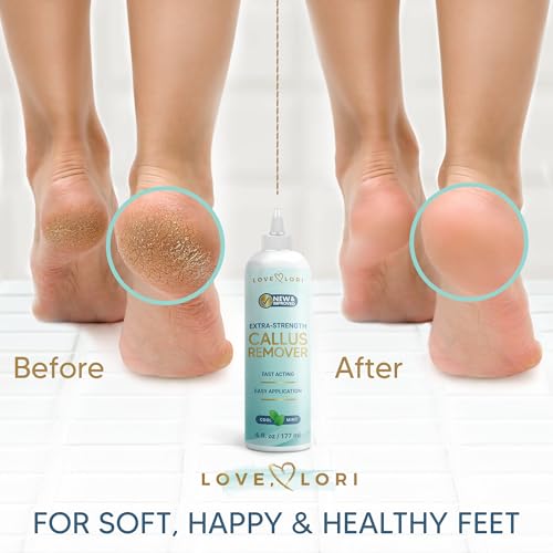 Love Lori Callus Remover Gel Extra Strength Pedicure Tool for Feet 6oz