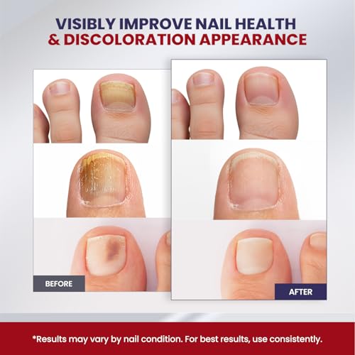Treatonic Square Toe Nail Fungal Patches Nighttime Repair (32Pcs) - Toenail Treatment for Discolored & Damaged Nails