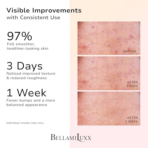 3-Step Butt Acne Clearing Routine: Cleanser Soap + Body Acne Scrub + Clearing Lotion for Breakouts on Butt, Thighs, Back, Clogged Pores & Rough Buttocks ? Exfoliate, Cleanse & Smooth
