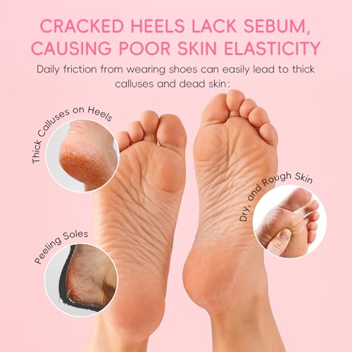 Sakura Heel Balm Stick for Cracked Feet & Dry Skin