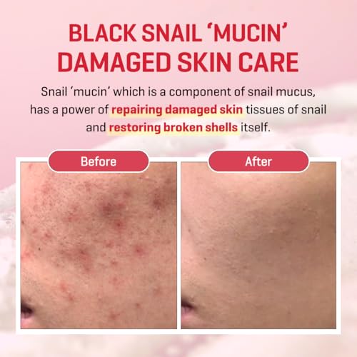 SOME BY MI Snail Truecica Miracle Repair Low pH Gel Cleanser - 3.38Oz, 100ml - Made from Snail Mucin for Sensitive Skin - Daily Face Wash for Deep Cleansing and Skin Moisturizing - Korean Skin Care