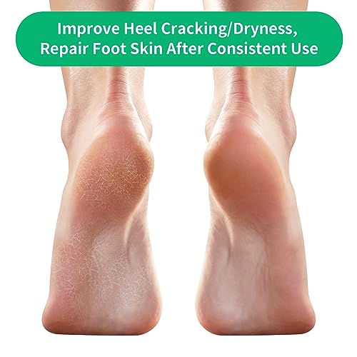 Ohtomber Gel Moisturizing Heel Socks for Dry Cracked Feet - 5 Pairs